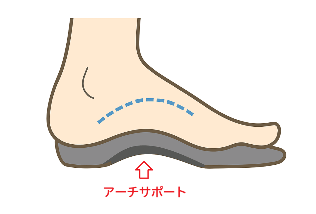 アーチサポート